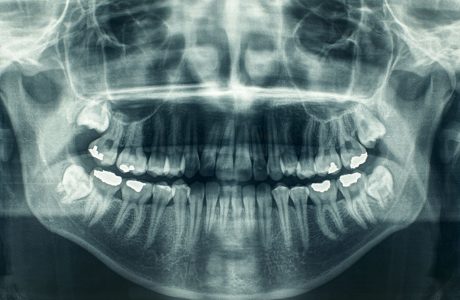 רשלנות כתוצאה מאי מומחיותו של רופא השיניים