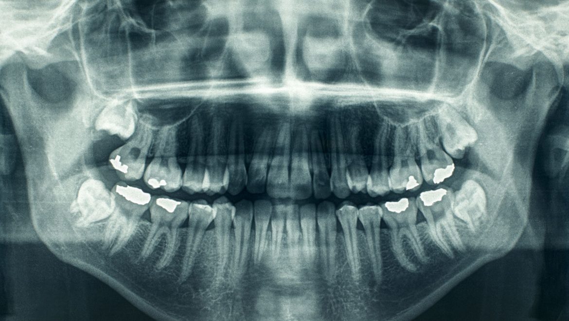 רשלנות כתוצאה מאי מומחיותו של רופא השיניים